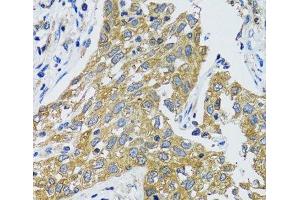 Immunohistochemistry (Paraffin-embedded Sections) (IHC (p)) image for anti-Glutamic-Oxaloacetic Transaminase 1, Soluble (Aspartate Aminotransferase 1) (GOT1) antibody (ABIN7261774)
