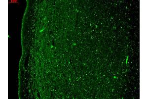 Immunohistochemistry (IHC) image for anti-Potassium Voltage-Gated Channel, KQT-Like Subfamily, Member 4 (KCNQ4) (AA 2-77) antibody (PE) (ABIN2483187)