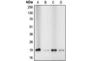 Western blot analysis of Cofilin expression in Jurkat (A), HeLa (B), MCF7 (C), A431 (D) whole cell lysates. (Cofilin 抗体  (N-Term))