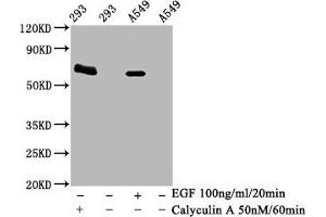 Western Blot Positive WB detected in 293 whole cell lysate 65549 whole cell lysate(treated with Calyculin A or EGF) All lanes Phospho-PRKAA2 antibody at 1. (Recombinant PRKAA2 抗体  (pThr172))