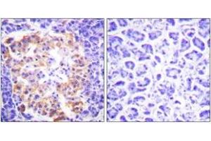 Immunohistochemistry (IHC) image for anti-Collagen, Type III (COL3) (AA 81-130) antibody (ABIN1533238)