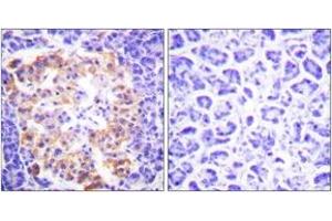 Immunohistochemistry analysis of paraffin-embedded human pancreas tissue, using Collagen III Antibody. (COL3 抗体  (AA 81-130))