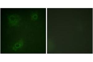 Immunofluorescence analysis of COS7 cells, using IRS-1 (Ab-323) Antibody. (IRS1 抗体  (AA 289-338))