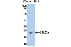 Western Blotting (WB) image for anti-Interleukin 18 Receptor Accessory Protein (IL18RAP) (AA 396-548) antibody (ABIN1174895) (IL18RAP 抗体  (AA 396-548))