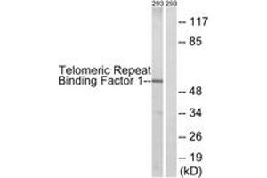 Western blot analysis of extracts from 293 cells, treated with Paclitaxel 1uM 24h, using Telomeric Repeat Binding Factor 1 (Ab-219) Antibody. (TRF1 抗体  (AA 185-234))