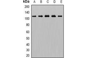 Western blot analysis of AP2-alpha-1 expression in THP1 (A), Hela (B), mouse brain (C), rat liver (D), rat lung (E) whole cell lysates. (alpha Adaptin 抗体)