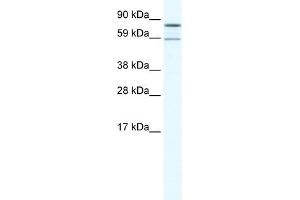 WB Suggested Anti-PARN Antibody Titration:  1. (PARN 抗体  (N-Term))