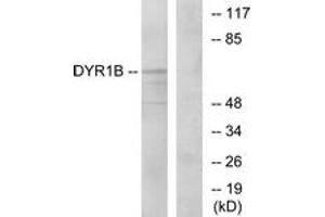 Western blot analysis of extracts from Jurkat cells, using DYR1B Antibody. (DYRK1B 抗体  (AA 331-380))