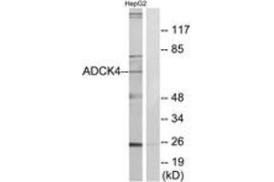 Western blot analysis of extracts from HepG2 cells, using ADCK4 Antibody. (ADCK4 抗体  (AA 31-80))