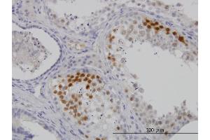 Immunoperoxidase of monoclonal antibody to CDK3 on formalin-fixed paraffin-embedded human testis. (CDK3 抗体  (AA 206-305))