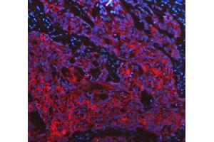 IF analysis of Cytokeratin 19 using anti-Cytokeratin 19 antibody (ABIN3043288). (Cytokeratin 19 抗体  (C-Term))