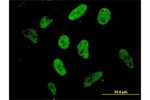Immunofluorescence (IF) image for anti-Sp1 Transcription Factor (SP1) (AA 89-198) antibody (ABIN562964)