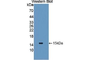 Western Blotting (WB) image for anti-Solute Carrier Family 2 (Facilitated Glucose Transporter), Member 14 (SLC2A14) (AA 1-105) antibody (ABIN7443179)