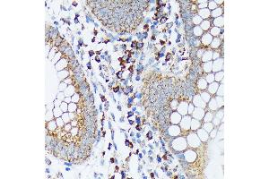Immunohistochemistry of paraffin-embedded human appendix using Sprouty 2 Rabbit mAb (ABIN7270554) at dilution of 1:100 (40x lens). (SPRY2 抗体)