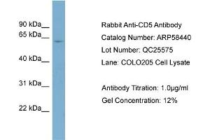 WB Suggested Anti-CD5  Antibody Titration: 0. (CD5 抗体  (N-Term))