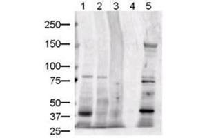 Image no. 3 for anti-Jagged 1 (JAG1) (AA 110-125) antibody (ABIN226630) (JAG1 抗体  (AA 110-125))