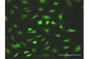 Immunofluorescence (IF) image for anti-Fanconi Anemia, Complementation Group C (FANCC) (AA 1-558) antibody (ABIN947854)
