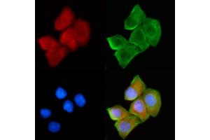 ABIN6265052 and ABIN6272430 staining Hela cells(30 min of UV treatment) by IF/ICC. (SH3BGR 抗体  (Internal Region))