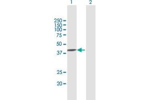Western Blot analysis of TXNDC5 expression in transfected 293T cell line by TXNDC5 MaxPab polyclonal antibody. (TXNDC5 抗体  (AA 1-360))
