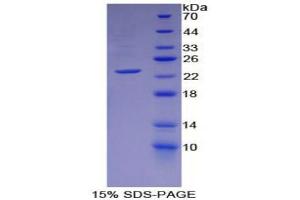 SDS-PAGE (SDS) image for Slow Skeletal Troponin I (TNNI1) (AA 1-187) protein (His tag) (ABIN2122261) (TNNI1 Protein (AA 1-187) (His tag))