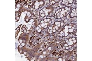 Immunohistochemical staining of human rectum with RLTPR polyclonal antibody  shows moderate cytoplasmic positivity in glandular cells at 1:50-1:200 dilution. (RLTPR 抗体)