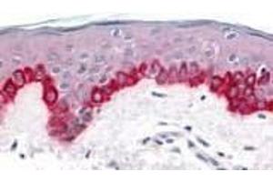 Immunohistochemistry of Apaf1 in human skin tissue with Apaf1 (CT) antibody at 20 μg/ml. (APAF1 抗体  (C-Term))