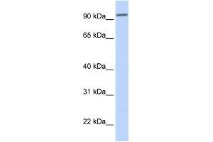 WB Suggested Anti-DPP6 Antibody Titration:  0. (DPP6 抗体  (Middle Region))