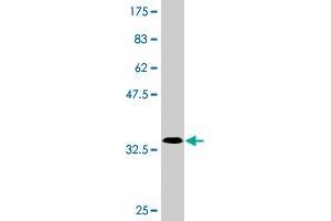 Western Blot detection against Immunogen (33. (SLC25A23 抗体  (AA 2-74))