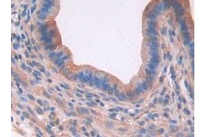 Detection of PON2 in Mouse Uterus Tissue using Polyclonal Antibody to Paraoxonase 2 (PON2) (PON2 抗体  (AA 4-289))