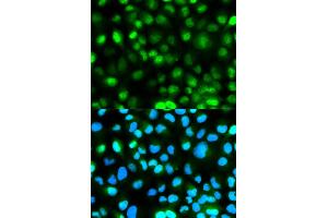 Immunofluorescence analysis of HeLa cells using ATXN3 antibody. (Ataxin 3 抗体)