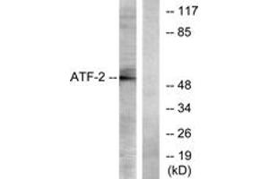 Western blot analysis of extracts from LOVO cells, using ATF2 (Ab-73 or 55) Antibody. (ATF2 抗体  (AA 40-89))
