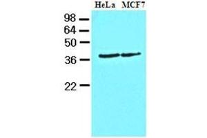 Cell lysates of HeLa and MCF7 (40 ug) were resolved by SDS-PAGE, transferred to nitrocellulose membrane and probed with anti-human Casein Kinase 1 alpha (1:1000). (CSNK1A1 抗体  (AA 1-337))