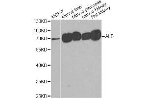 Western blot analysis of extracts of various cell lines, using ALB antibody. (Albumin 抗体)