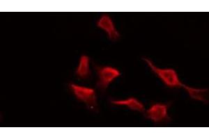 Immunofluorescence (fixed cells) (IF/ICC) image for anti-Endothelin Receptor Type A (EDNRA) (C-Term) antibody (ABIN6257158)
