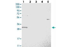 Western blot analysis of Lane 1: RT-4, Lane 2: U-251 MG, Lane 3: Human Plasma, Lane 4: Liver, Lane 5: Tonsil with WBSCR27 polyclonal antibody  at 1:250-1:500 dilution. (WBSCR27 抗体)