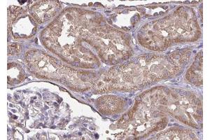Immunohistochemistry (IHC) image for anti-Cytochrome P450, Family 2, Subfamily J, Polypeptide 2 (CYP2J2) (Internal Region) antibody (ABIN6261201)