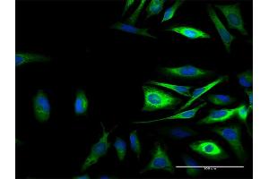 Immunofluorescence of purified MaxPab antibody to CAST on HeLa cell. (Calpastatin 抗体  (AA 1-686))