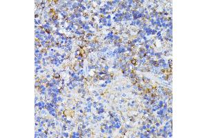 Immunohistochemistry of paraffin-embedded mouse spleen using CAD antibody (ABIN6130029, ABIN6137837, ABIN6137838 and ABIN6224367) at dilution of 1:100 (40x lens). (CAD 抗体  (AA 1650-1900))