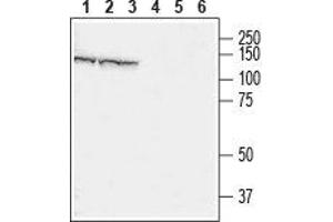 Western blot analysis of rat brain (lanes 1 and 4), mouse brain (lanes 2 and 5) and mouse C2C12 muscle myoblast cell line (lanes 3 and 6) lysates: - 1-3. (CHERP 抗体  (Cytosolic))