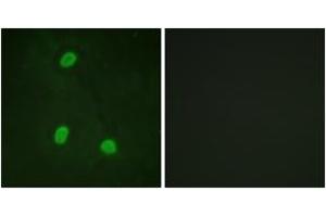 Immunofluorescence analysis of HeLa cells, using NIPA (Ab-354) Antibody. (ZC3HC1 抗体  (AA 320-369))