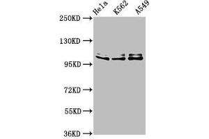 Western Blot Positive WB detected in: Hela whole cell lysate, K562 whole cell lysate, A549 whole cell lysate All lanes: XAB2 antibody at 3 μg/mL Secondary Goat polyclonal to rabbit IgG at 1/50000 dilution Predicted band size: 101 kDa Observed band size: 101 kDa (XAB2 抗体  (AA 750-840))