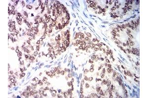 Immunohistochemistry (IHC) image for anti-Mismatch Repair Protein 2 (MSH2) (AA 442-586) antibody (ABIN7193508)