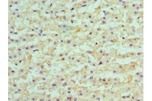 Immunohistochemistry (IHC) image for anti-Sulfotransferase Family, Cytosolic, 2A, Dehydroepiandrosterone (DHEA)-Preferring, Member 1 (SULT2A1) (AA 1-145) antibody (ABIN7145594)