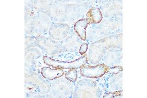 Immunohistochemistry of paraffin-embedded mouse kidney using NDUFV1 Rabbit pAb  at dilution of 1:100 (40x lens). (NDUFV1 抗体  (AA 1-250))