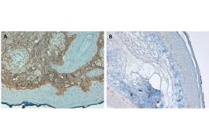 Immunohistochemistry (IHC) image for anti-Collagen, Type I, alpha 1 (COL1A1) antibody (FITC) (ABIN5596822)