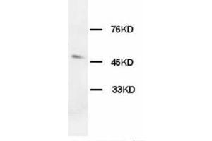 Image no. 2 for anti-Hypocretin (Orexin) Receptor 1 (HCRTR1) (C-Term) antibody (ABIN1492942) (HCRTR1 抗体  (C-Term))