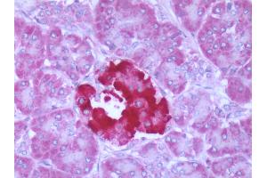 Human Pancreas: Formalin-Fixed, Paraffin-Embedded (FFPE) (FFAR1 抗体  (Cytoplasmic Domain))