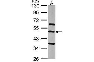 WB Image Sample (30 ug of whole cell lysate) A: A431 , 10% SDS PAGE antibody diluted at 1:2000 (TRHR 抗体  (C-Term))