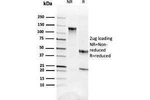 SDS-PAGE Analysis Purified Fodrin Mouse Monoclonal Antibody (SPTAN1/3352). (SPTAN1 抗体  (AA 2351-2475))
