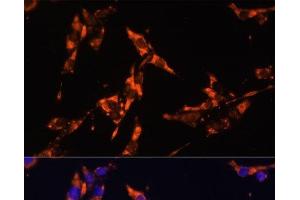 Immunofluorescence analysis of HeLa cells using IL18 Polyclonal Antibody at dilution of 1:100. (IL-18 抗体)